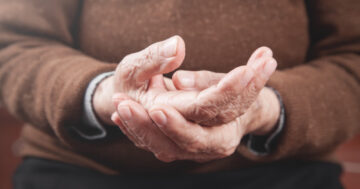 โรคพาร์กินสัน