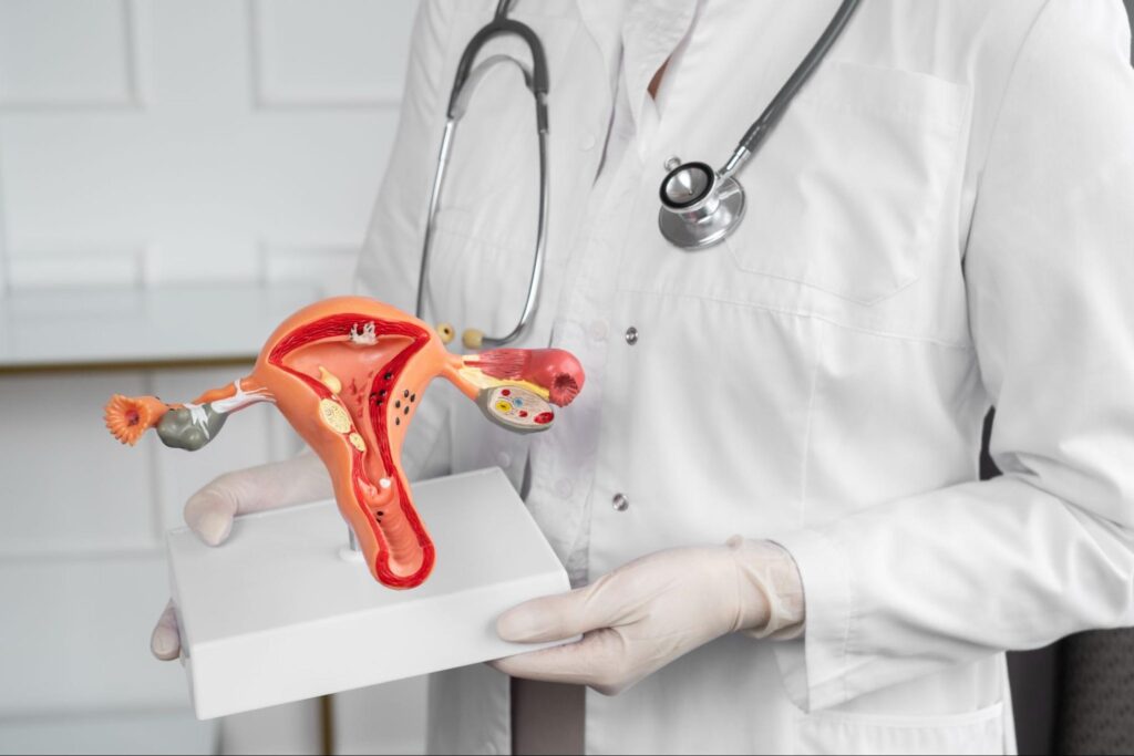 Myomectomy