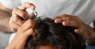 ยาแก้ผมร่วง