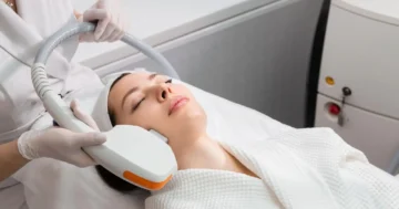 Ultraformer III ควรทำกี่ช็อต