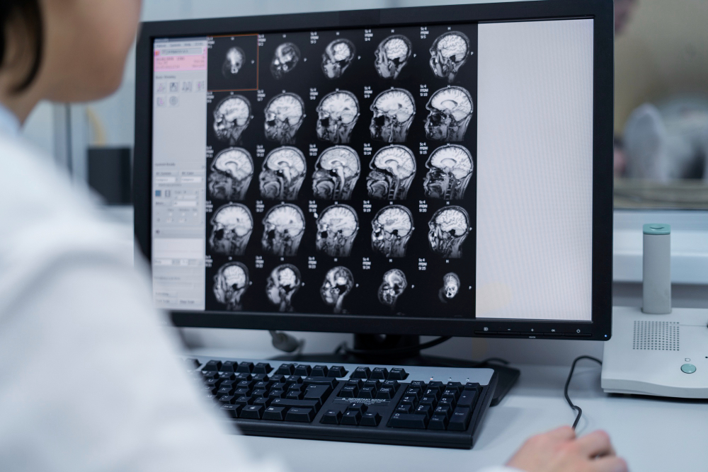 MRI 3 tesla ประโยชน์