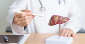 มะเร็งท่อน้ำดี