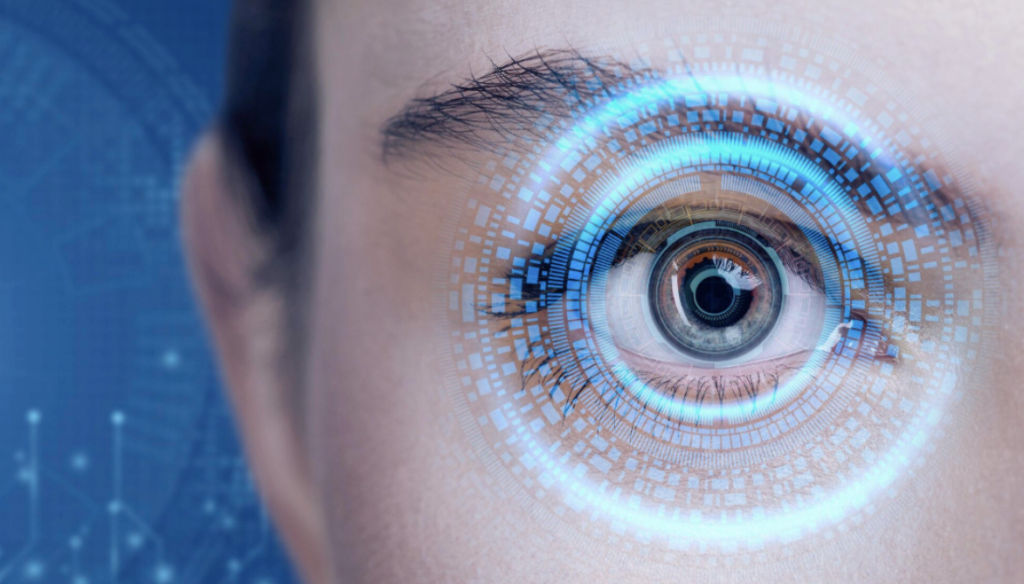 Lasik